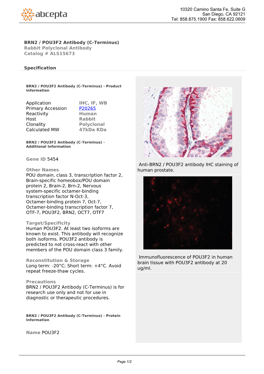 BRN2 / POU3F2 Antibody (C-Terminus) Rabbit Polyclonal Antibody Catalog # ALS15673