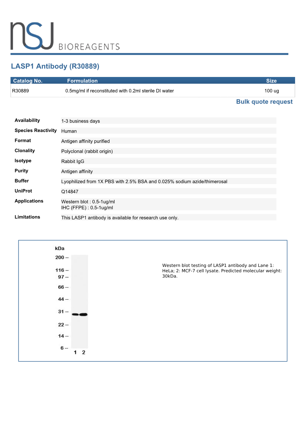 LASP1 Antibody (R30889)