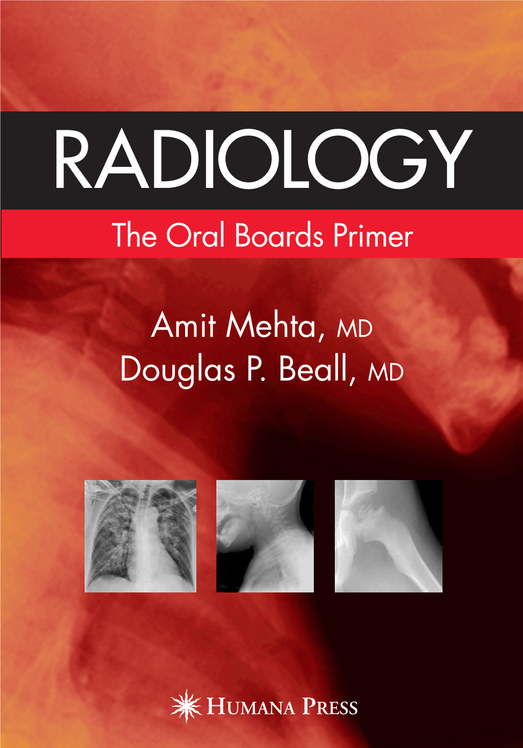 Amit Mehta, MD Douglas P. Beall, MD RADIOLOGY