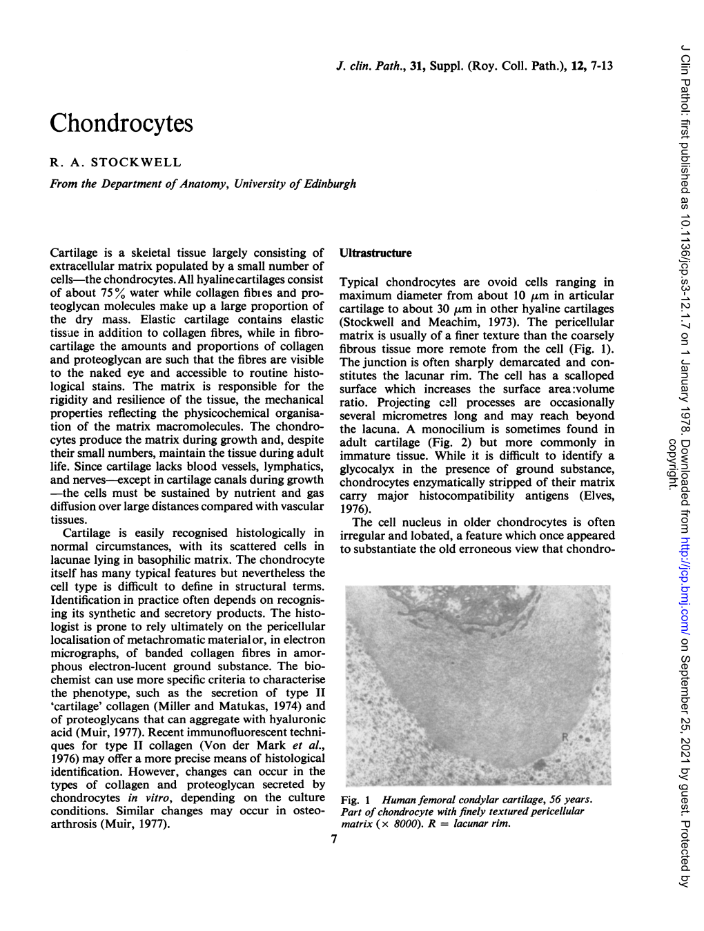 Chondrocytes