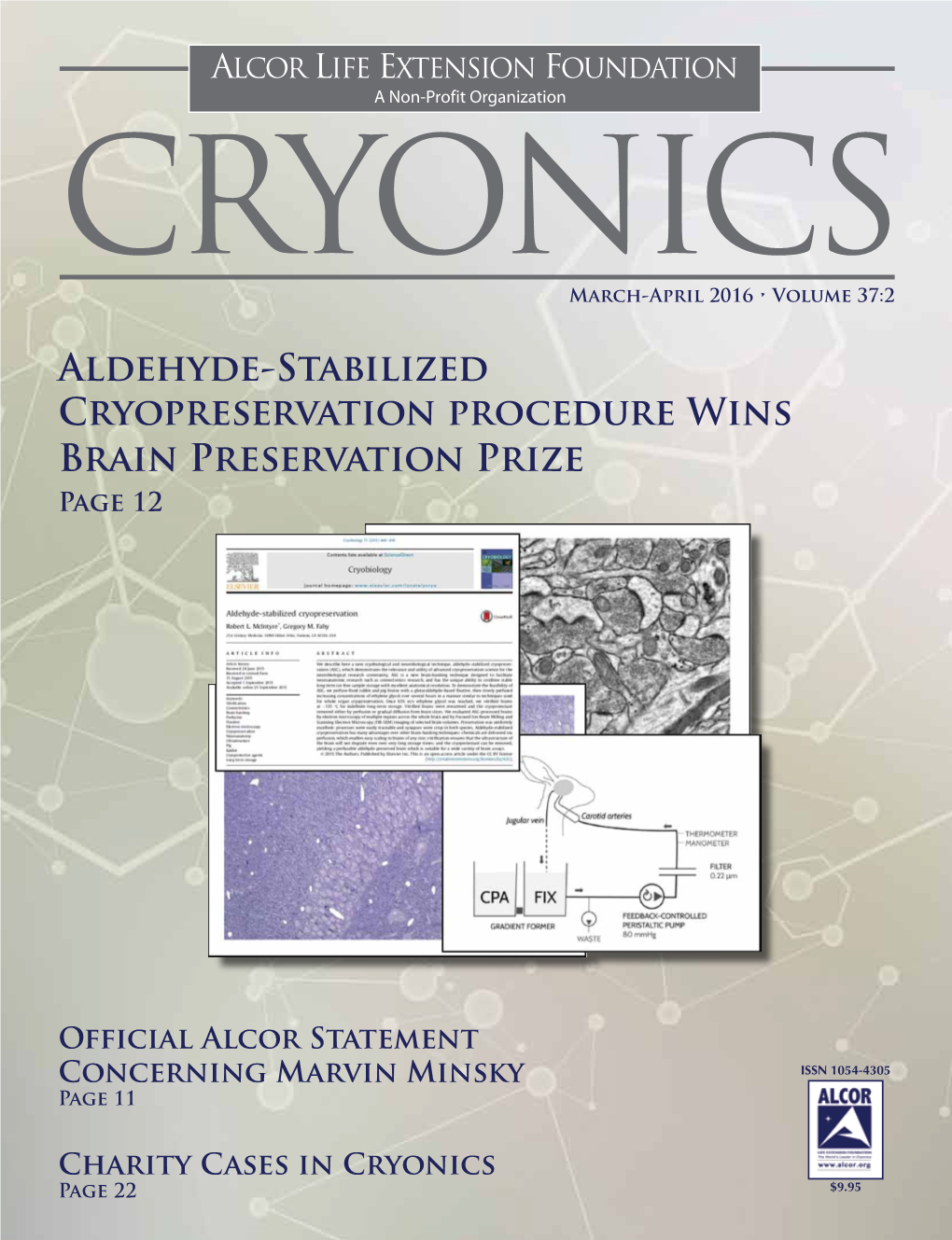 Aldehyde-Stabilized Cryopreservation Procedure Wins Brain Preservation Prize Page 12