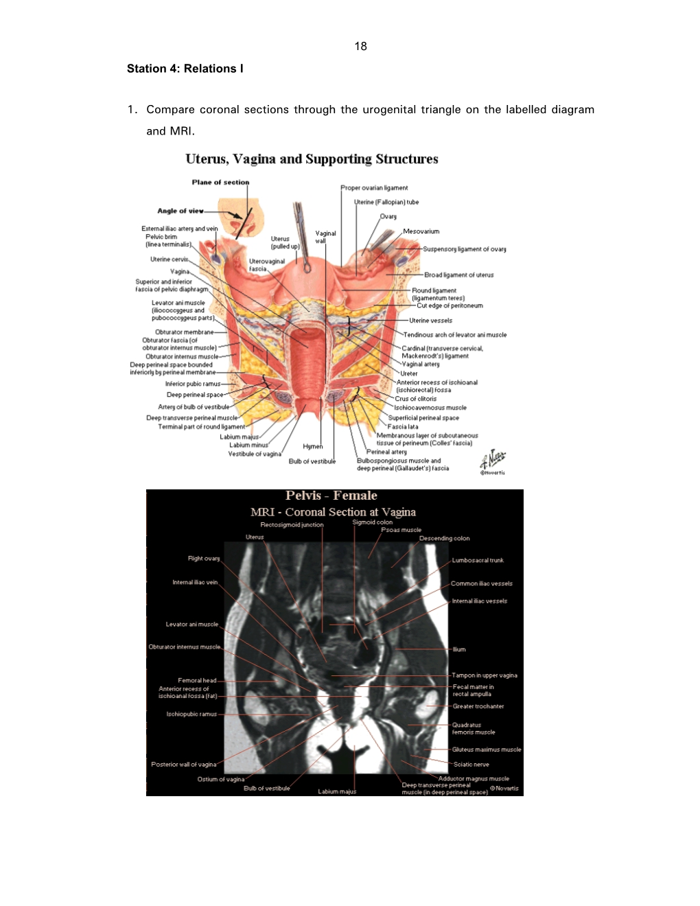 18 Station 4: Relations I 1. Compare Coronal Sections Through The