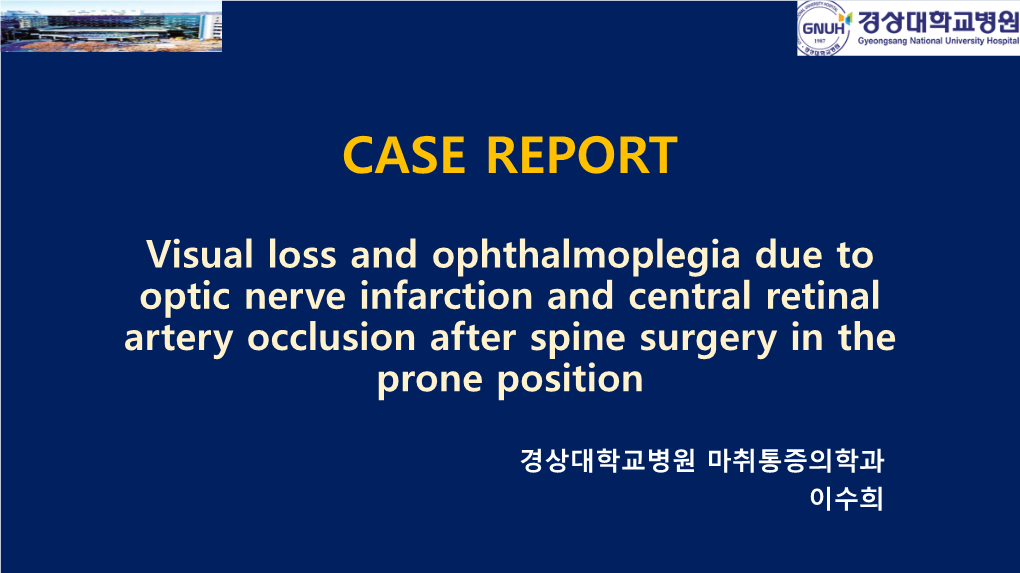 Visual Loss and Ophthalmoplegia Due to Optic Nerve Infarction and Central Retinal Artery Occlusion After Spine Surgery in the Prone Position