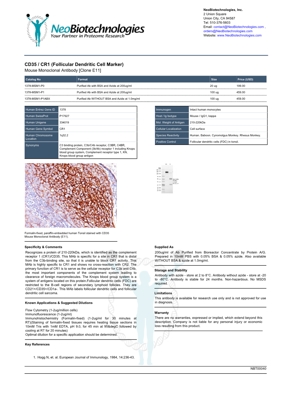 CD35 / CR1 (Follicular Dendritic Cell Marker) Mouse Monoclonal Antibody [Clone E11]