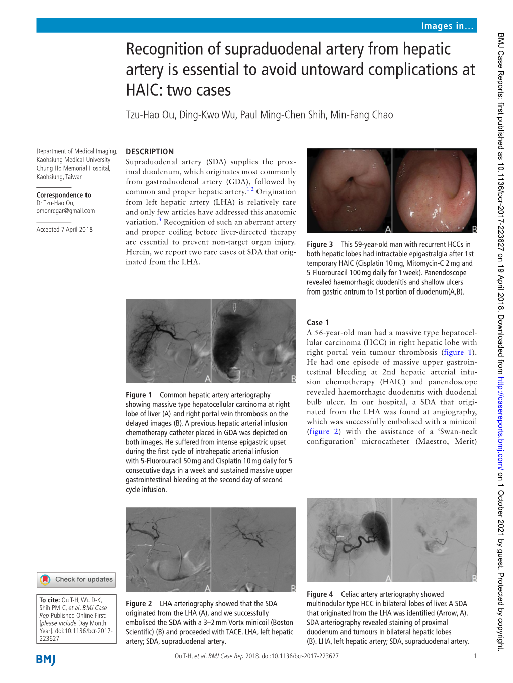 Recognition of Supraduodenal Artery from Hepatic