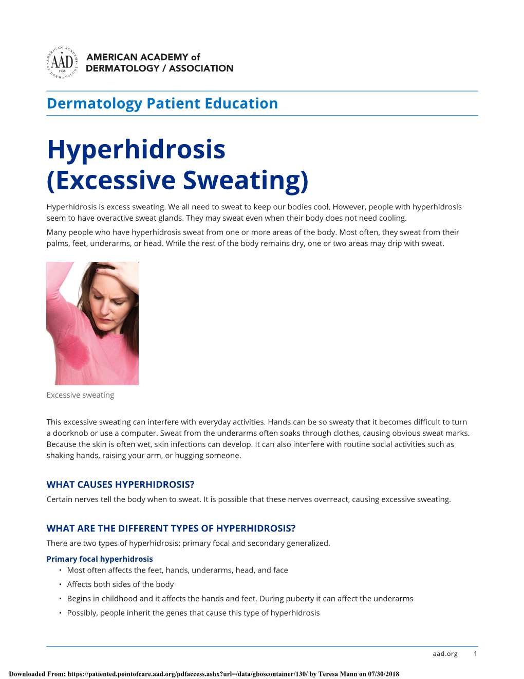 Hyperhidrosis (Excessive Sweating) Hyperhidrosis Is Excess Sweating