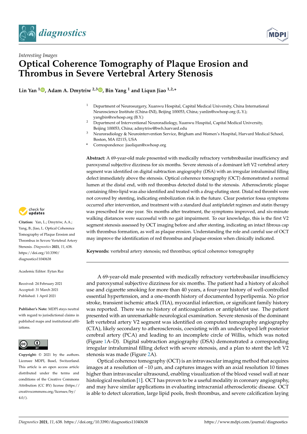 Optical Coherence Tomography of Plaque Erosion and Thrombus in Severe Vertebral Artery Stenosis