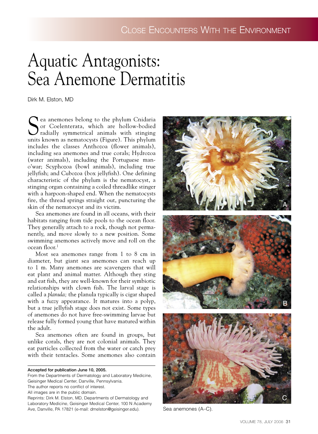 Sea Anemone Dermatitis