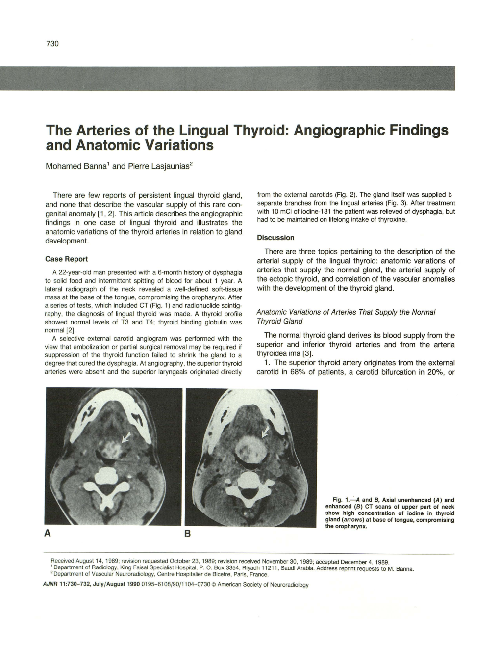 The Arteries of the Lingual Thyroid: Angiographic Findings and Anatomic Variations