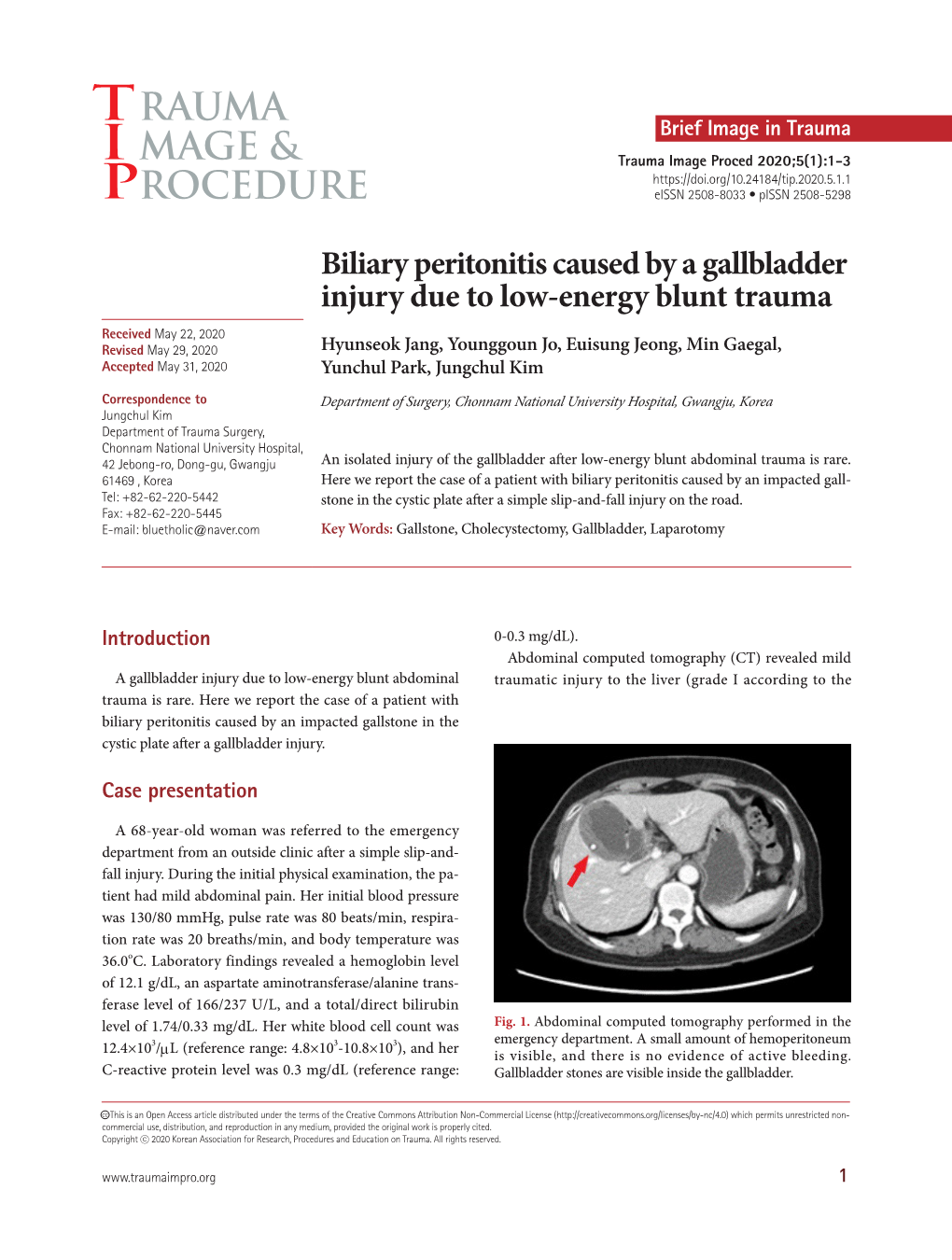 Biliary Peritonitis Caused by a Gallbladder Injury Due to Low