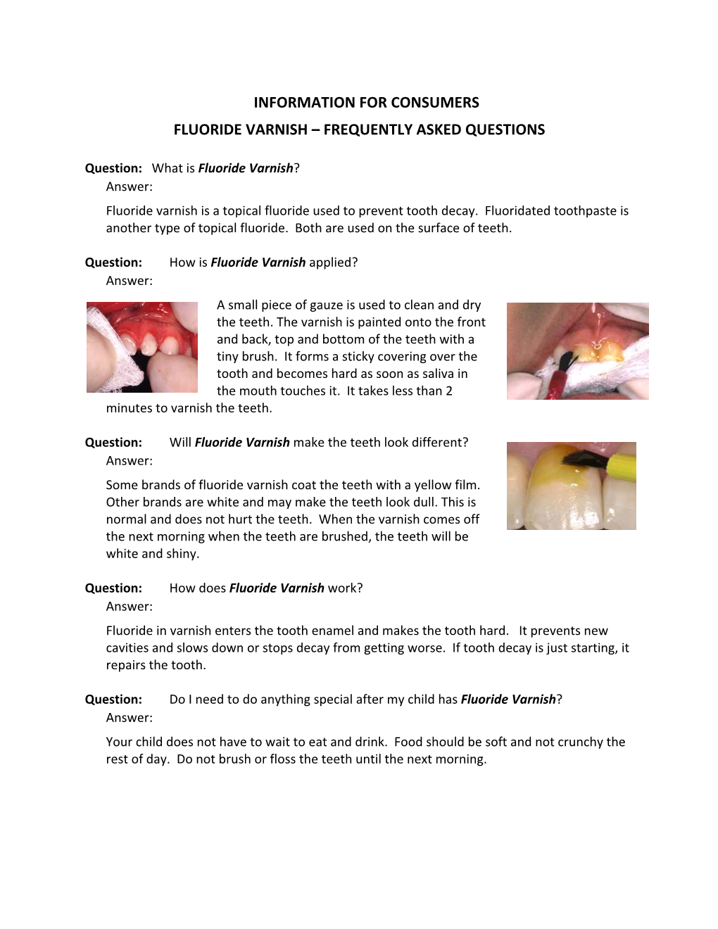 Information for Consumers: Fluoride Varnish