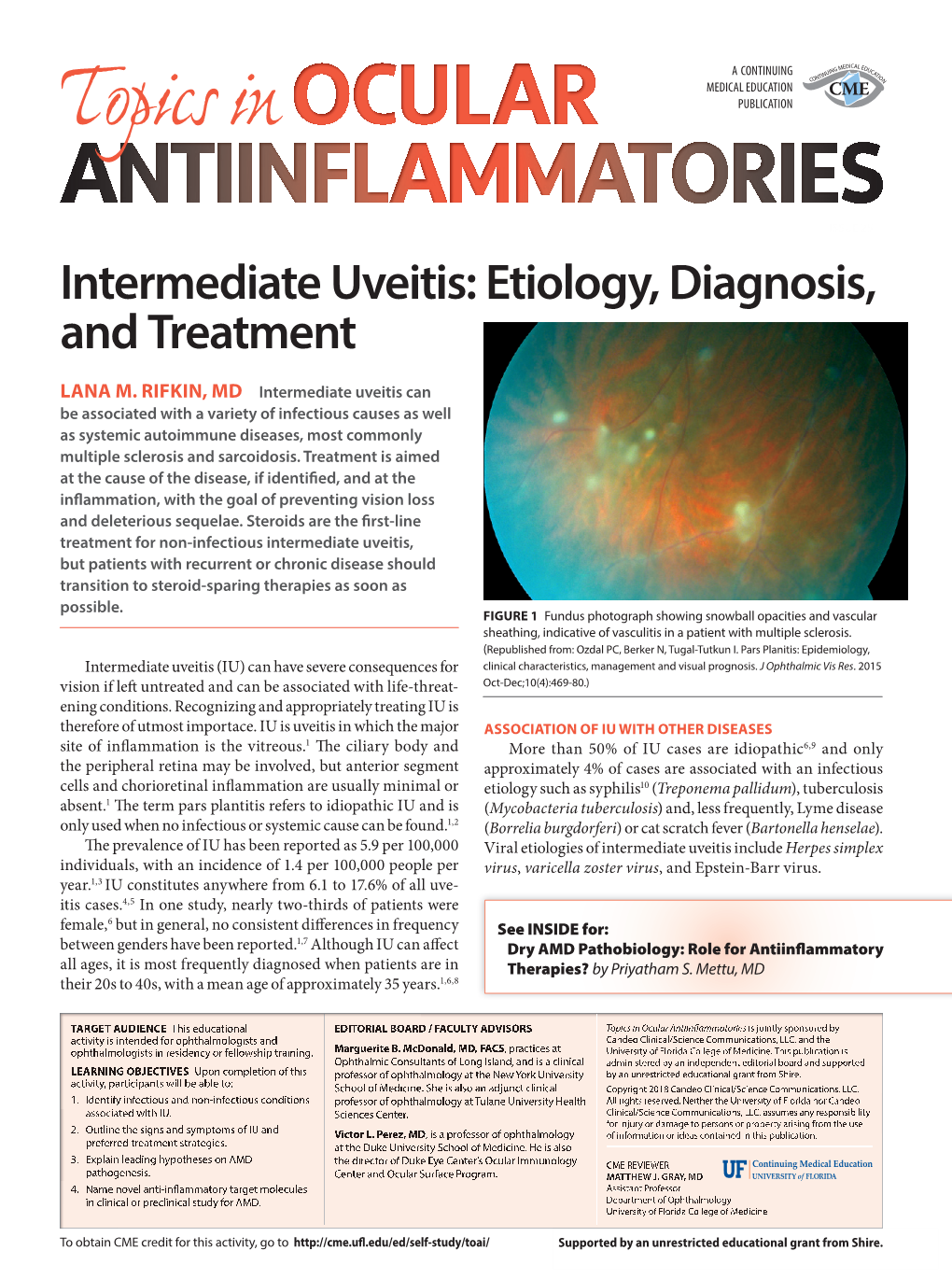 Intermediate Uveitis: Etiology, Diagnosis, and Treatment