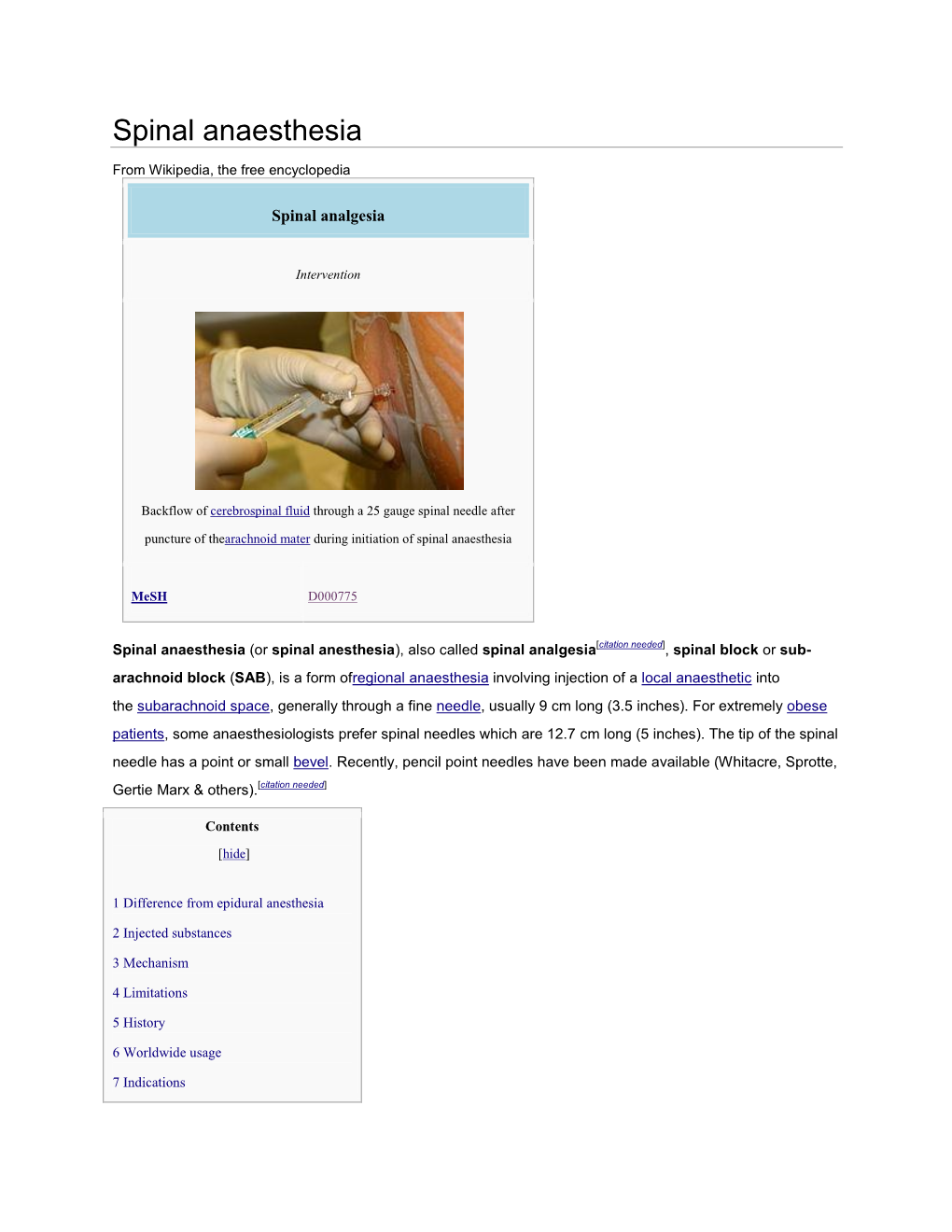 Spinal Anaesthesia