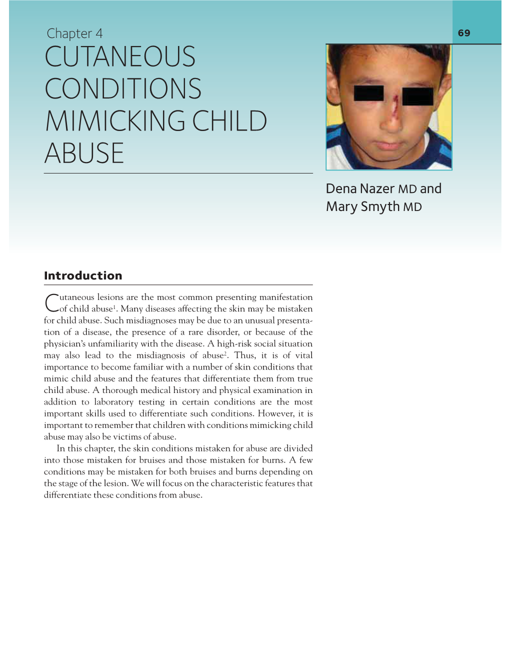 Cutaneous Conditions Mimicking Child Abuse