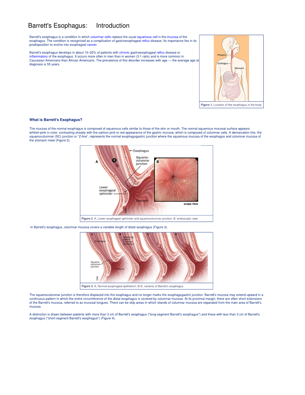 Barrett's Esophagus: Introduction