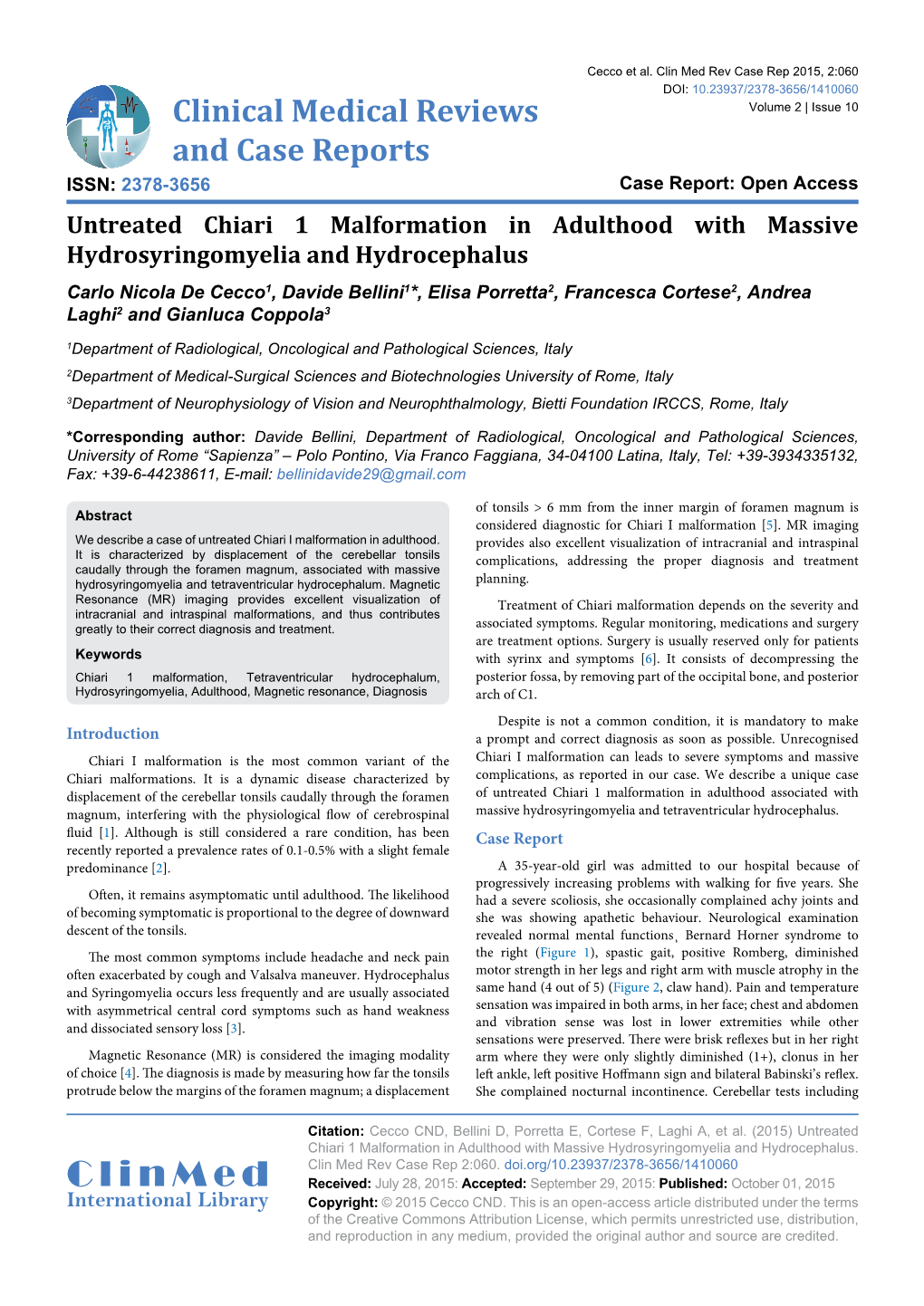 Untreated Chiari 1 Malformation in Adulthood With