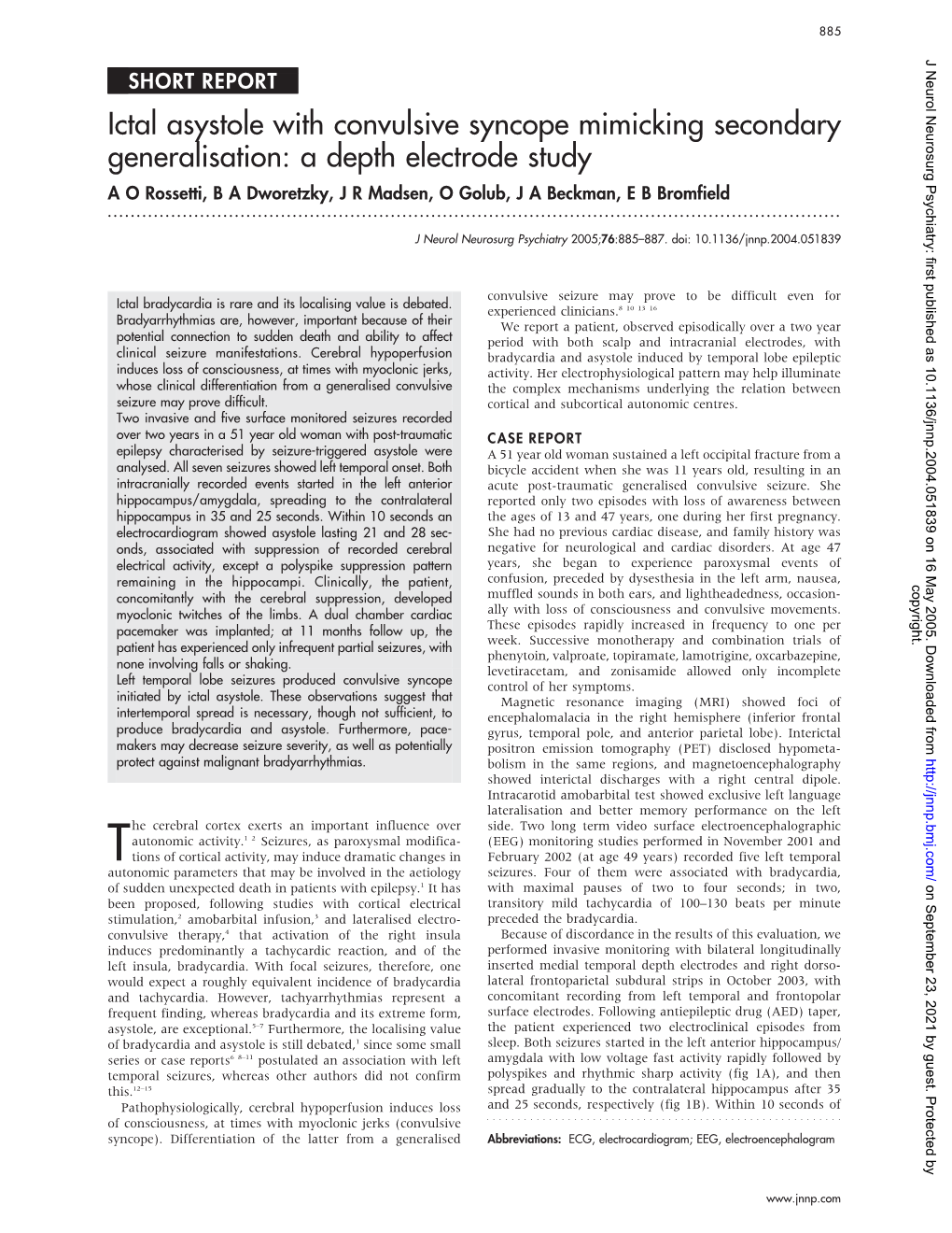 Ictal Asystole with Convulsive Syncope Mimicking Secondary Generalisation