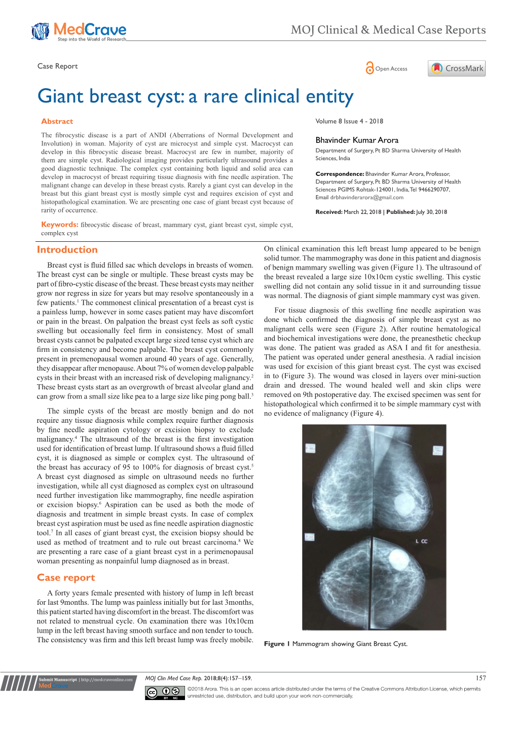 Giant Breast Cyst: a Rare Clinical Entity