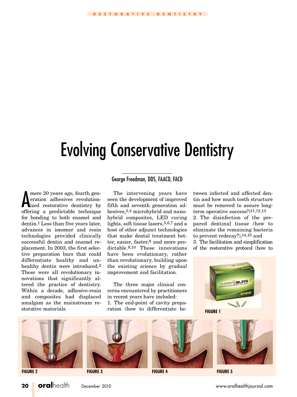 Evolving Conservative Dentistry