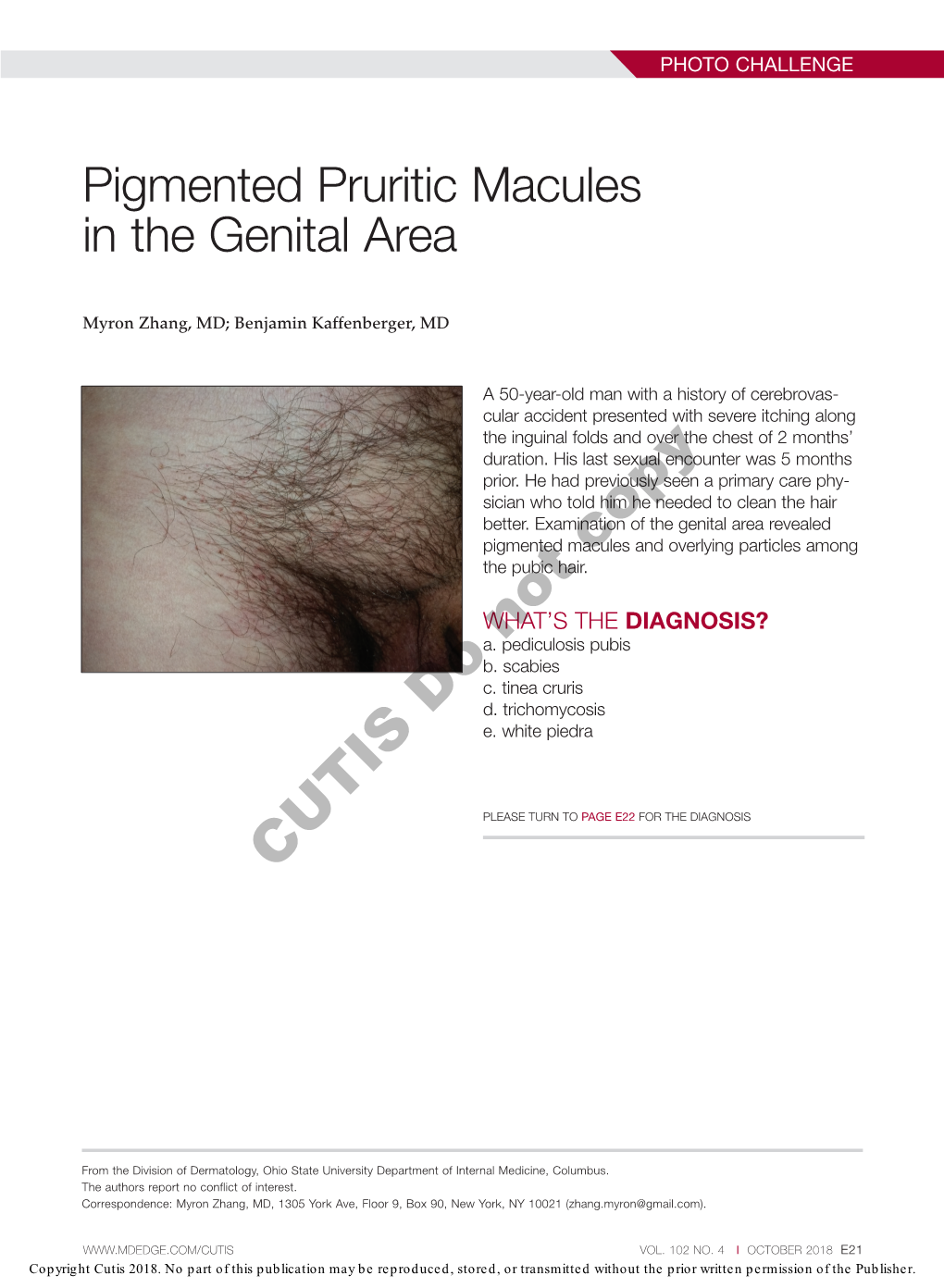 Pigmented Pruritic Macules in the Genital Area
