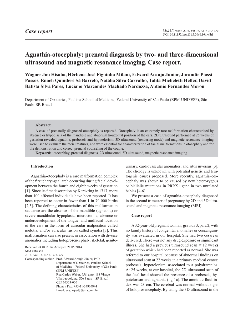 Agnathia-Otocephaly: Prenatal Diagnosis by Two- and Three-Dimensional Ultrasound and Magnetic Resonance Imaging