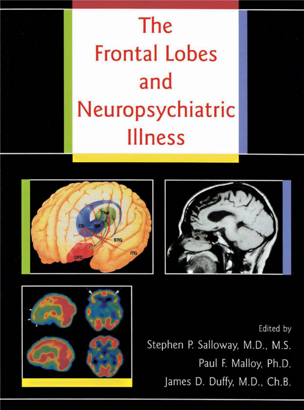 Frontal Lobes and Neuropsychiatric Illness This Page Intentionally Left Blank the Frontal Lobes and Neuropsychiatric Illness