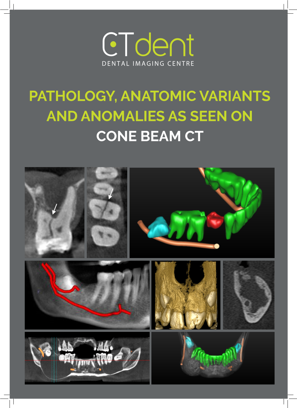 PATHOLOGY, ANATOMIC VARIANTS and ANOMALIES AS SEEN on CONE BEAM CT CBCT Pathology