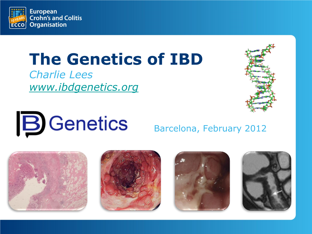 Crohn's Disease