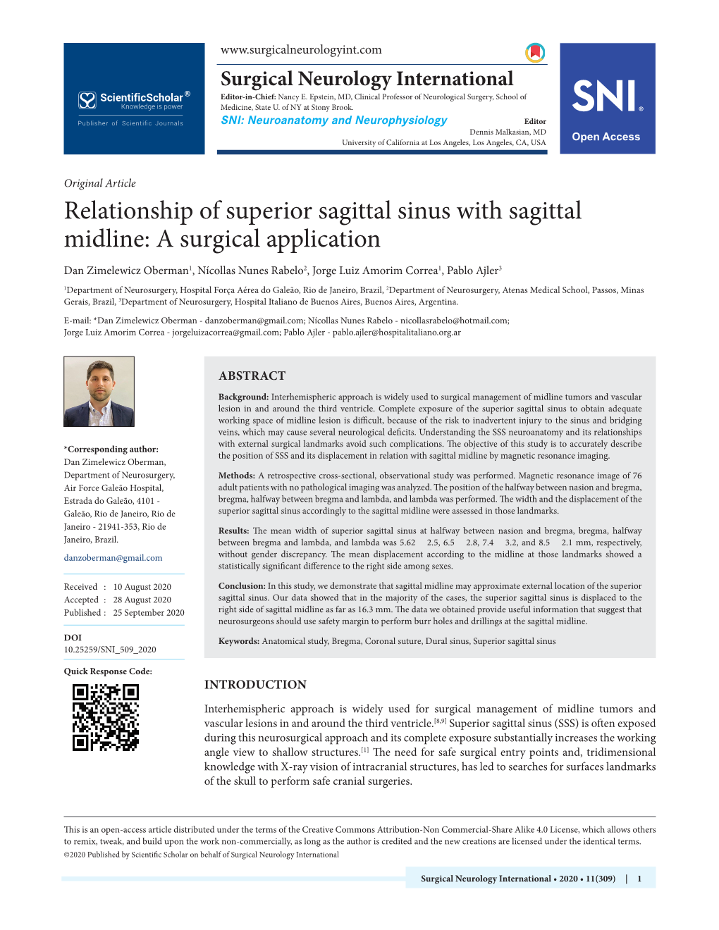 Relationship of Superior Sagittal Sinus with Sagittal Midline