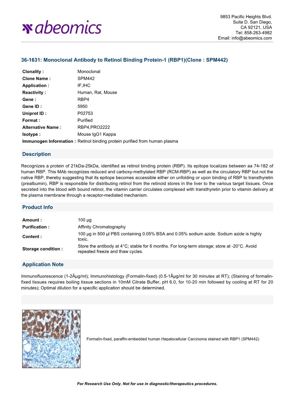 36-1631: Monoclonal Antibody to Retinol Binding Protein-1 (RBP1)(Clone : SPM442)