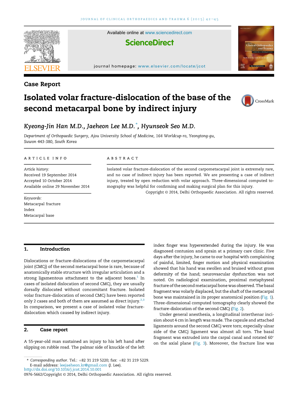 Isolated Volar Fracture-Dislocation of the Base of the Second Metacarpal Bone by Indirect Injury