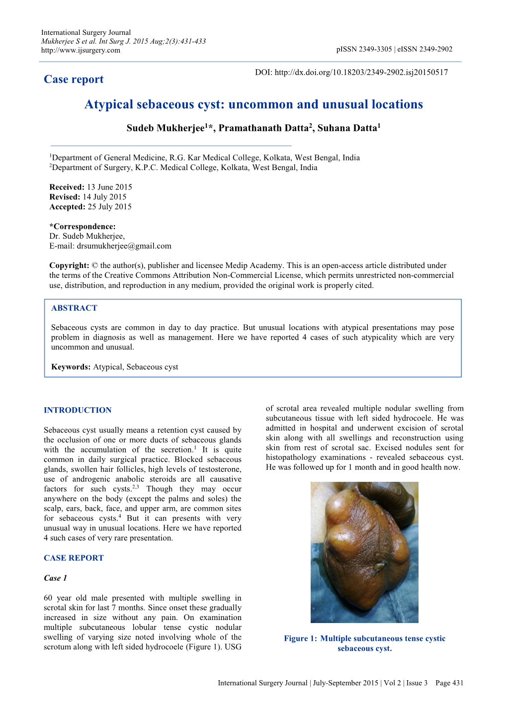 Atypical Sebaceous Cyst: Uncommon and Unusual Locations