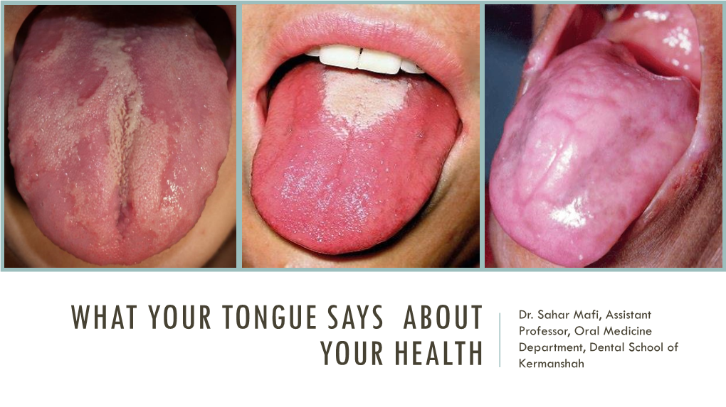 What Your Tongue Says About Your Health