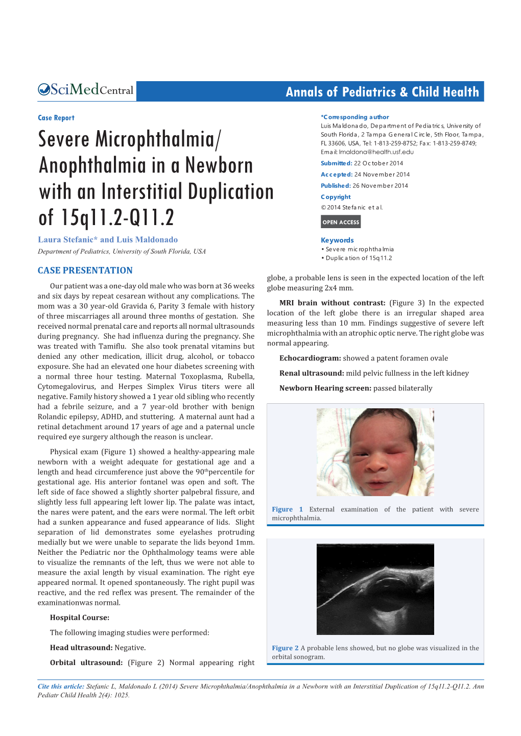 Severe Microphthalmia/Anophthalmia in a Newborn with an Interstitial Duplication of 15Q11.2-Q11.2