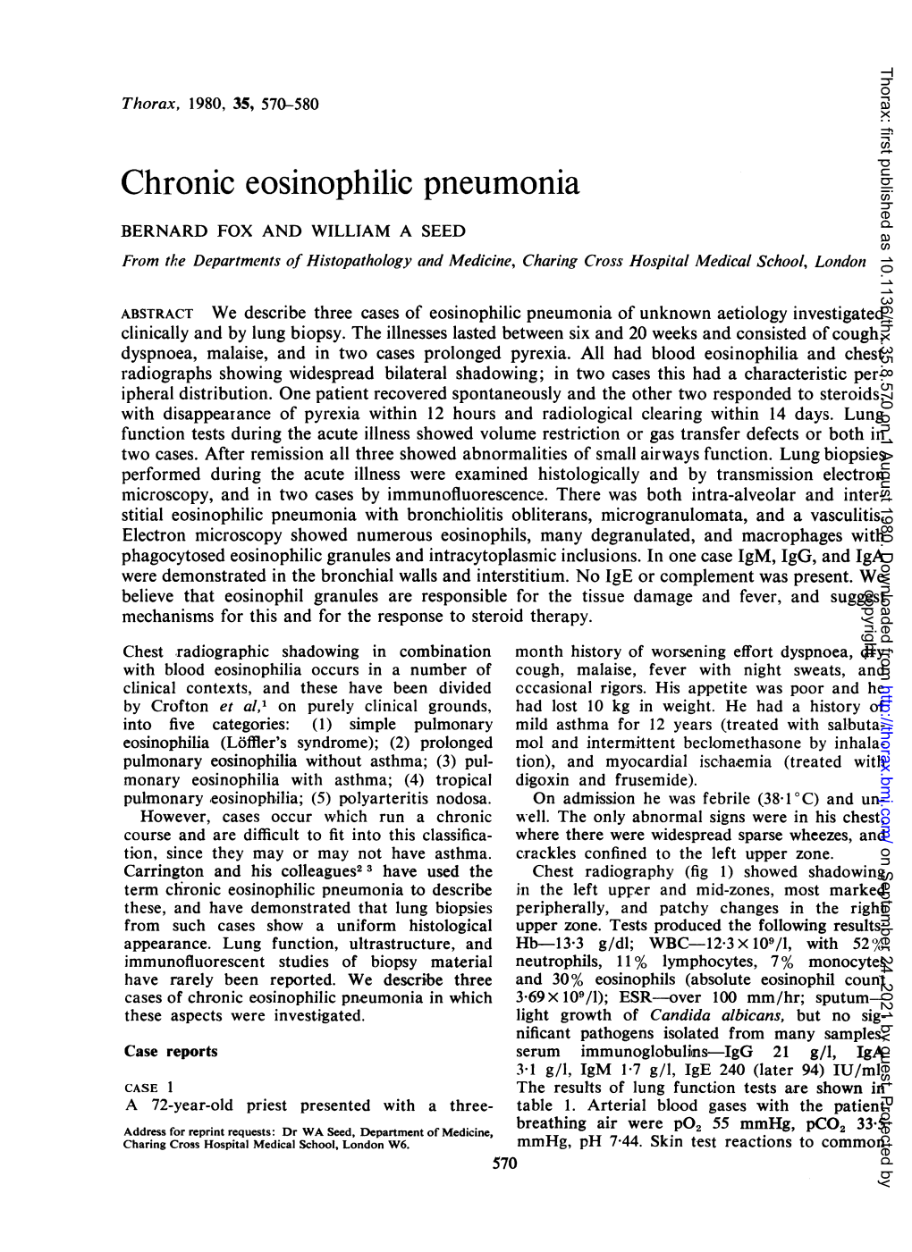 Chronic Eosinophilic Pneumonia