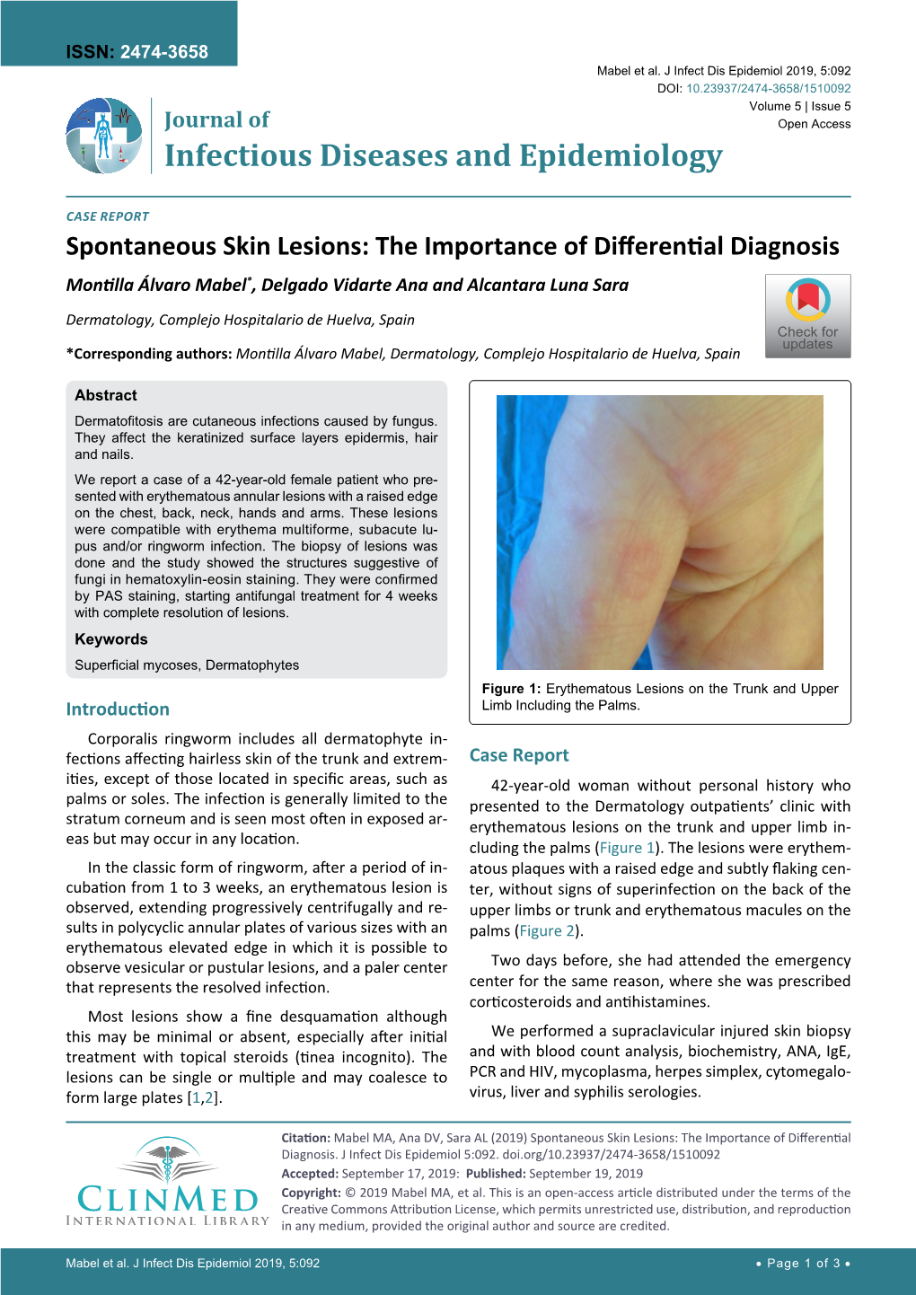 Spontaneous Skin Lesions: the Importance of Differential Diagnosis Montilla Álvaro Mabel*, Delgado Vidarte Ana and Alcantara Luna Sara