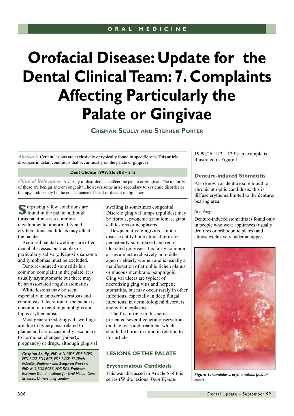 7. Complaints Affecting Particularly the Palate Or Gingivae