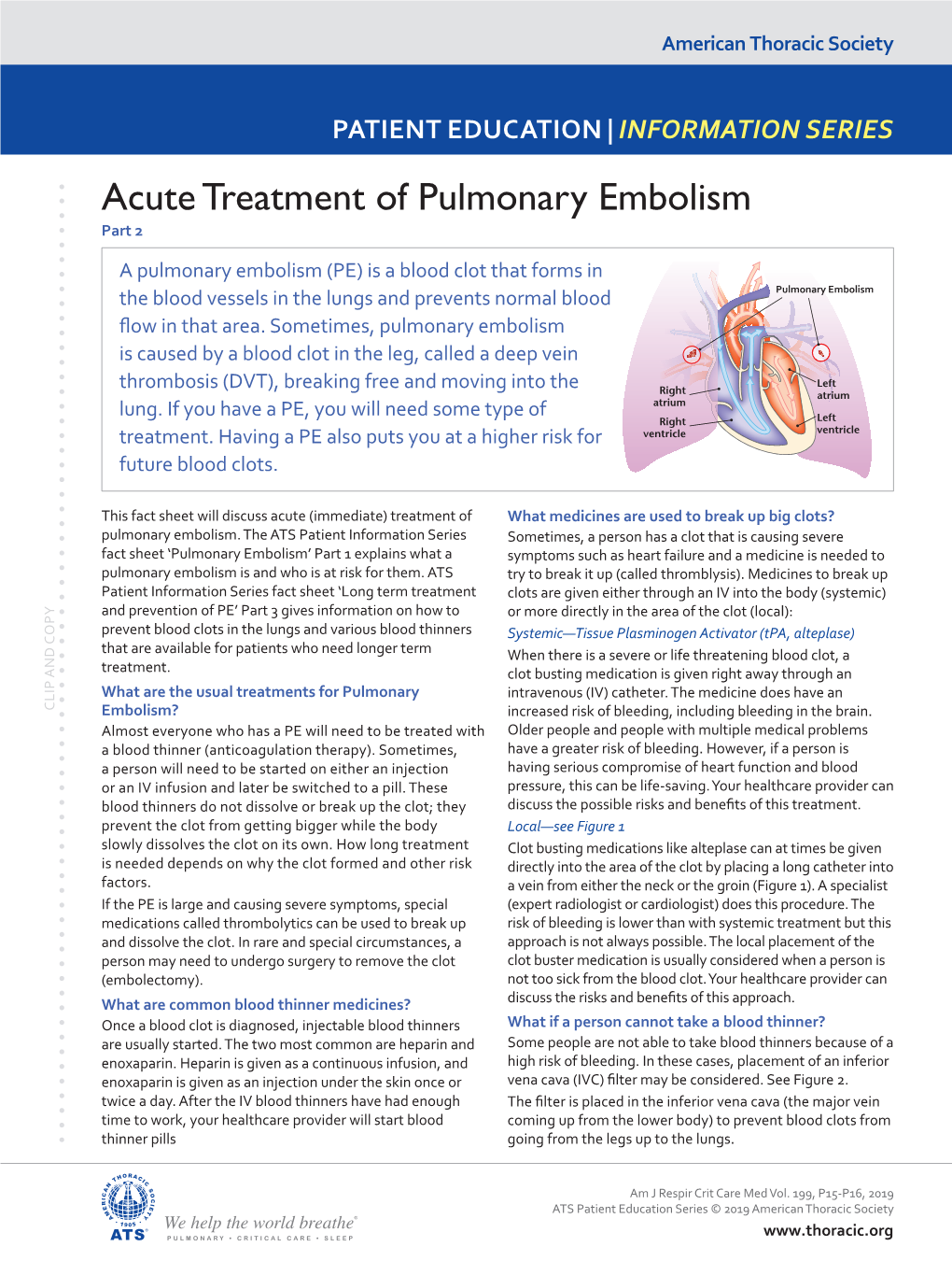 Acute Treatment of Pulmonary Embolism Part 2