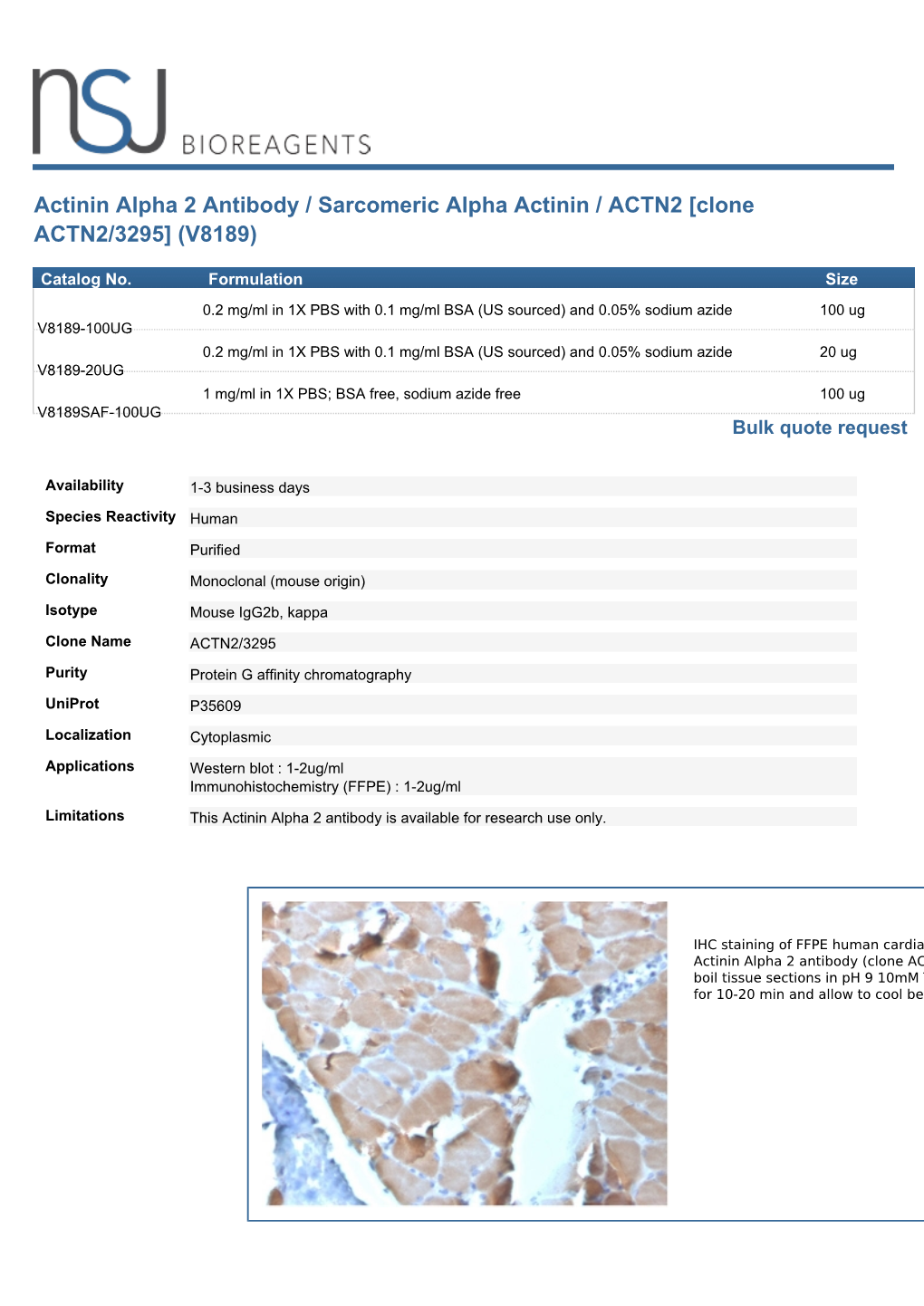 Actinin Alpha 2 Antibody / Sarcomeric Alpha Actinin / ACTN2 [Clone ACTN2/3295] (V8189)