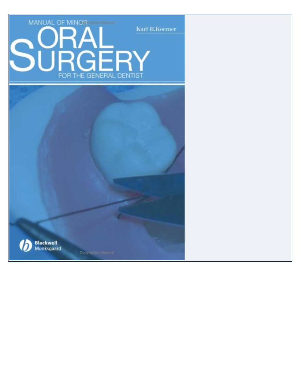 Manual of Minor Oral Surgery for the General Dentist - LEK4R