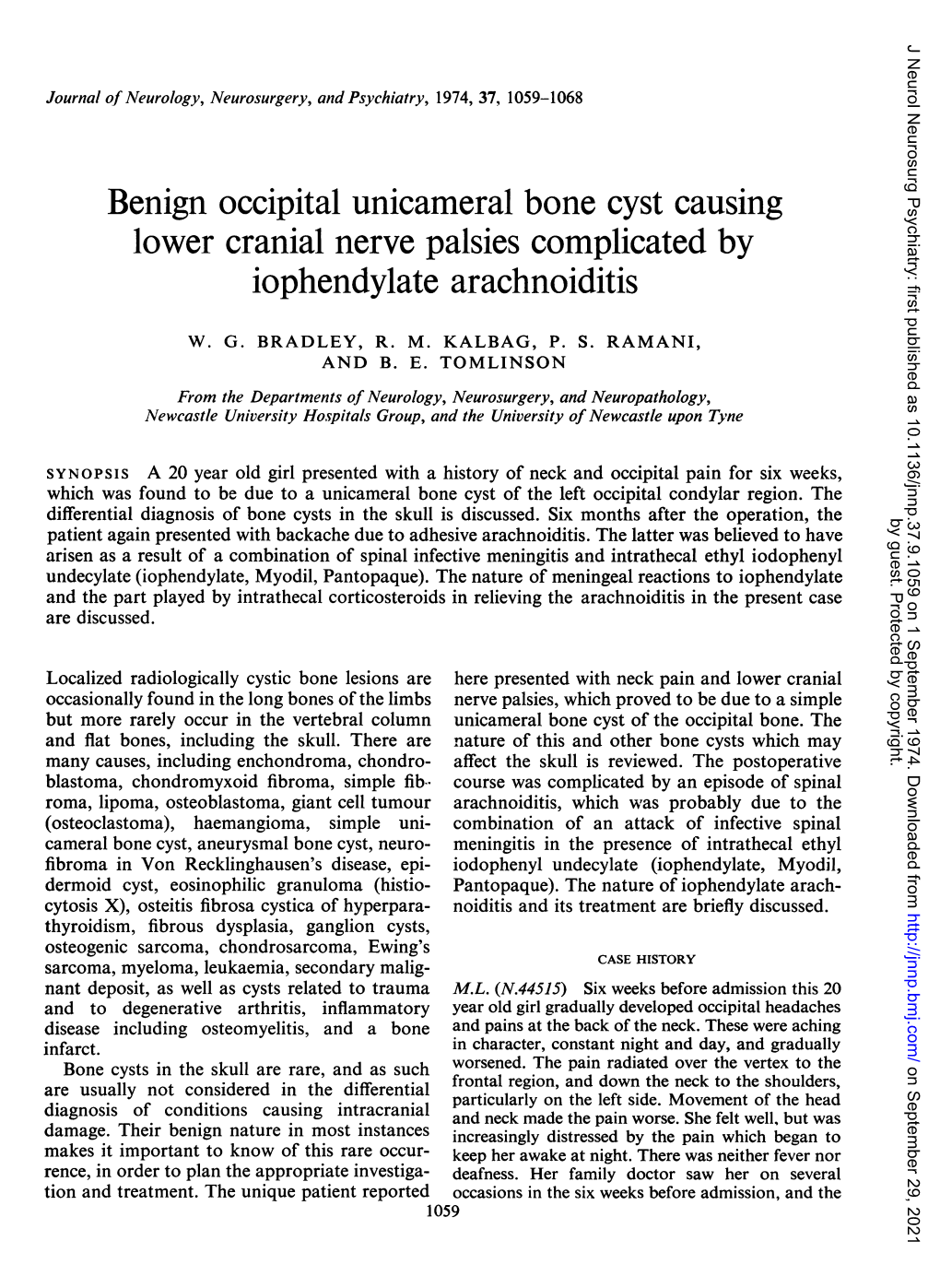 Benign Occipital Unicameral Bone Cyst Causing Lower Cranial Nerve Palsies Complicated by Iophendylate Arachnoiditis