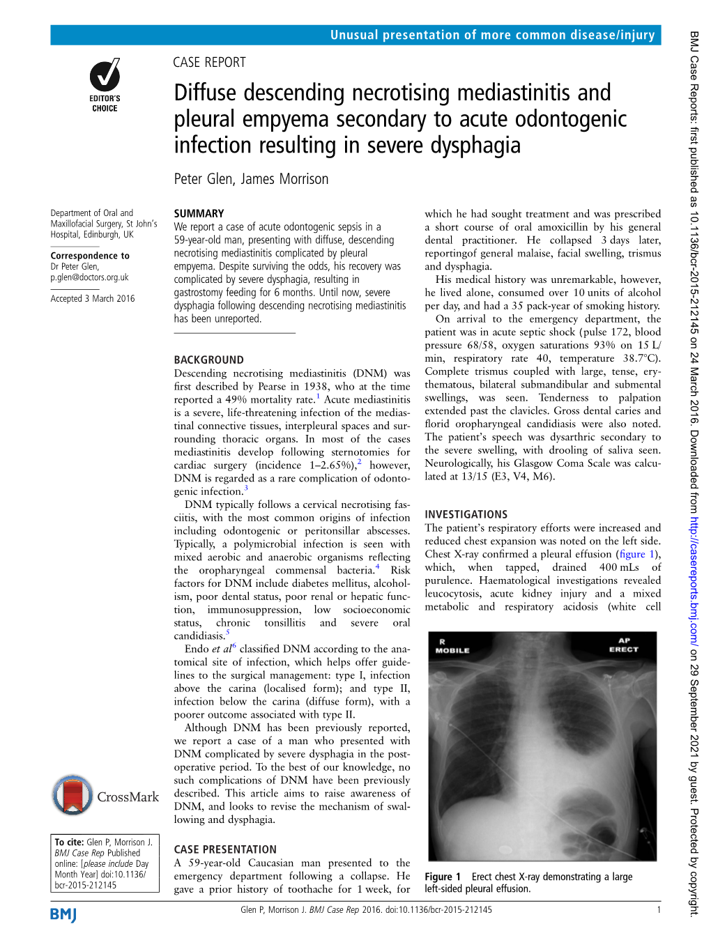 Diffuse Descending Necrotising Mediastinitis and Pleural Empyema Secondary to Acute Odontogenic Infection Resulting in Severe Dysphagia Peter Glen, James Morrison