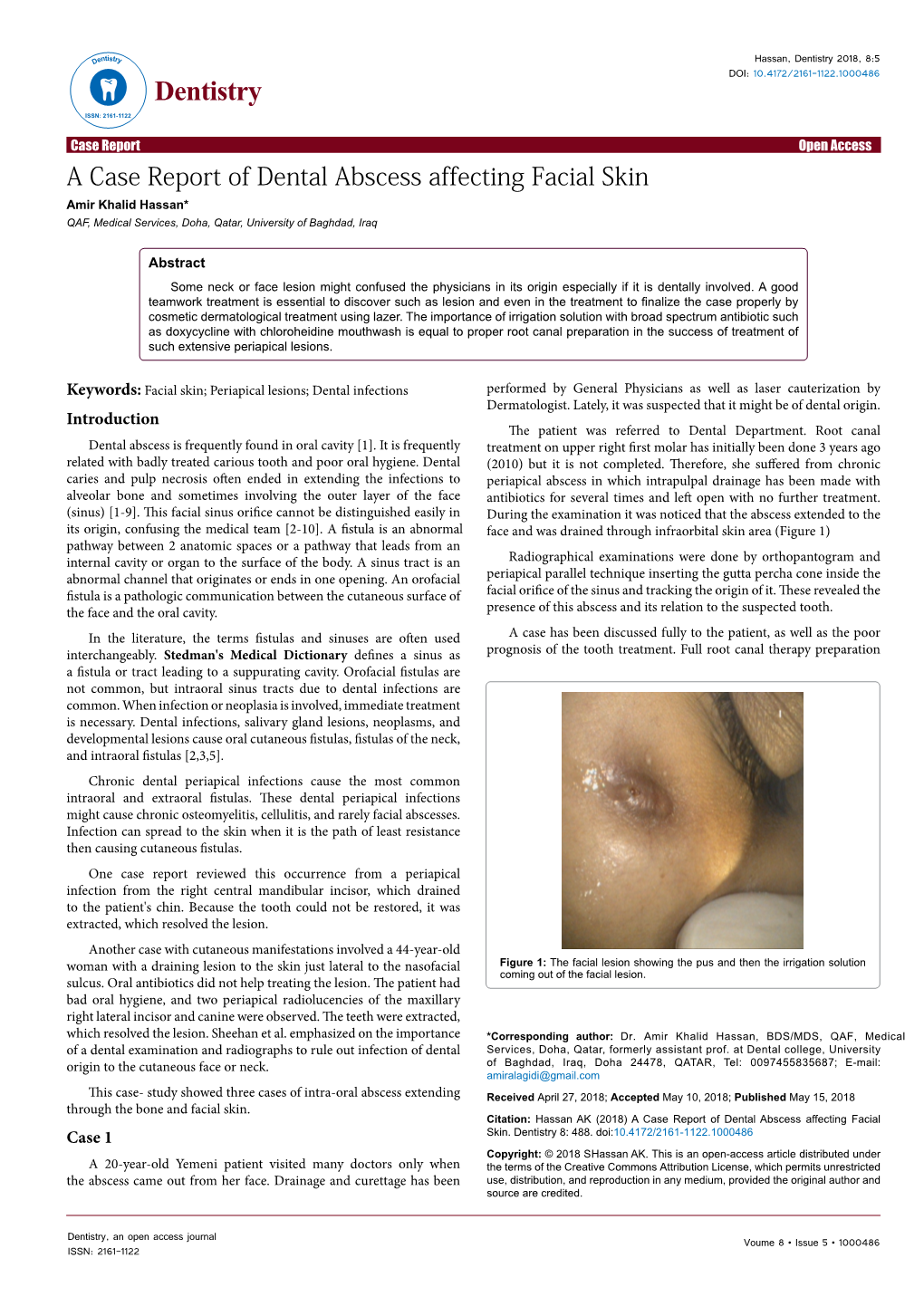 A Case Report of Dental Abscess Affecting Facial Skin Amir Khalid Hassan* QAF, Medical Services, Doha, Qatar, University of Baghdad, Iraq