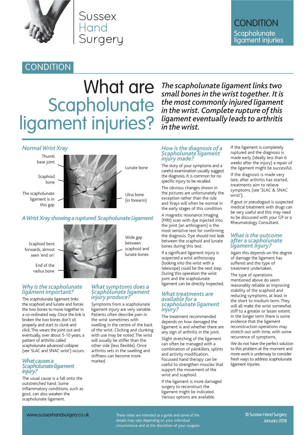 What Are Scapholunate Ligament Injuries?