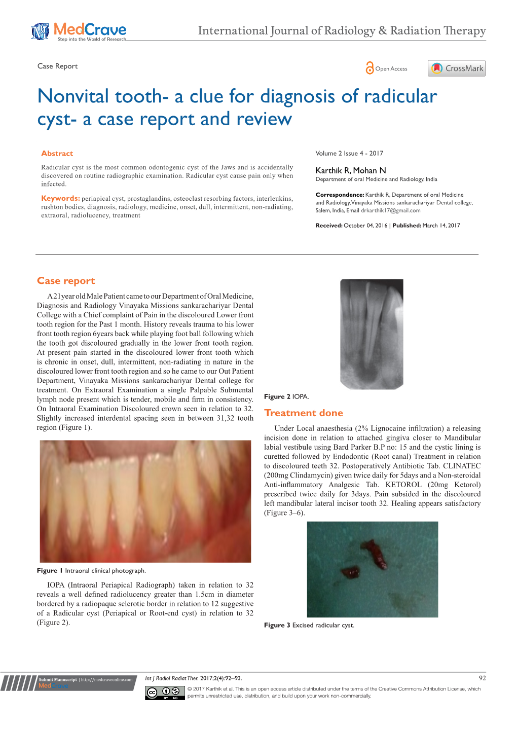 Nonvital Tooth- a Clue for Diagnosis of Radicular Cyst- a Case Report and Review
