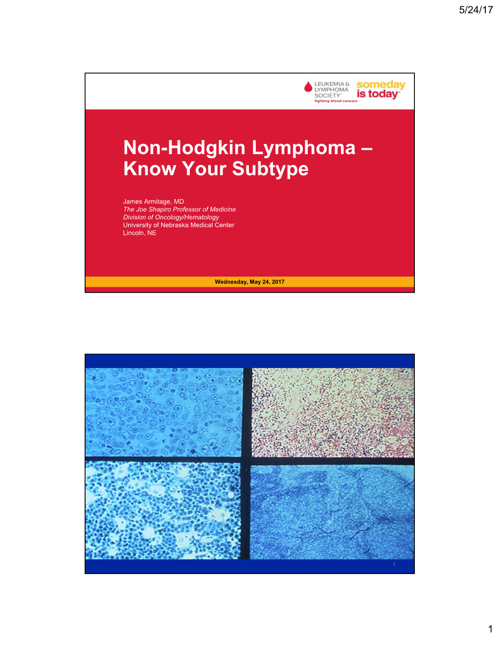 Non-Hodgkin Lymphoma – Know Your Subtype