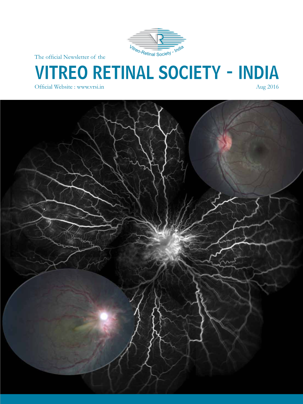 VITREO RETINAL SOCIETY - INDIA Official Website : Aug 2016