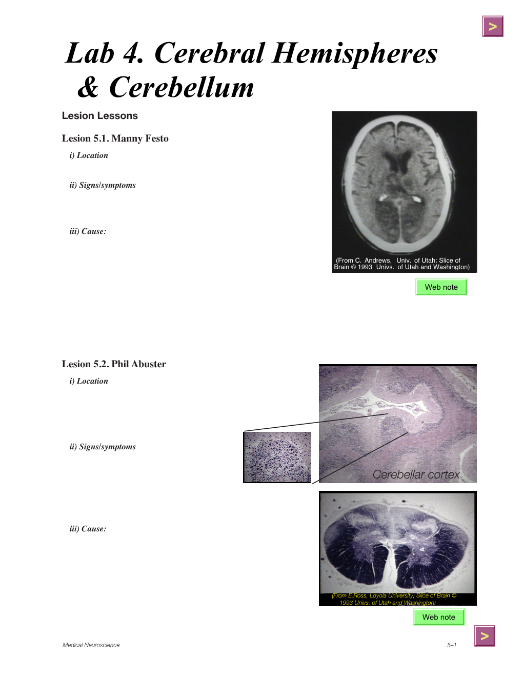 Lab 4. Cerebral Hemispheres & Cerebellum