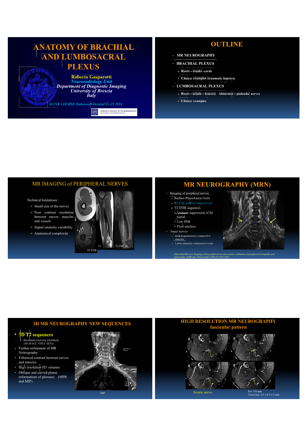 Anatomy of Brachial and Lumbosacral Plexus