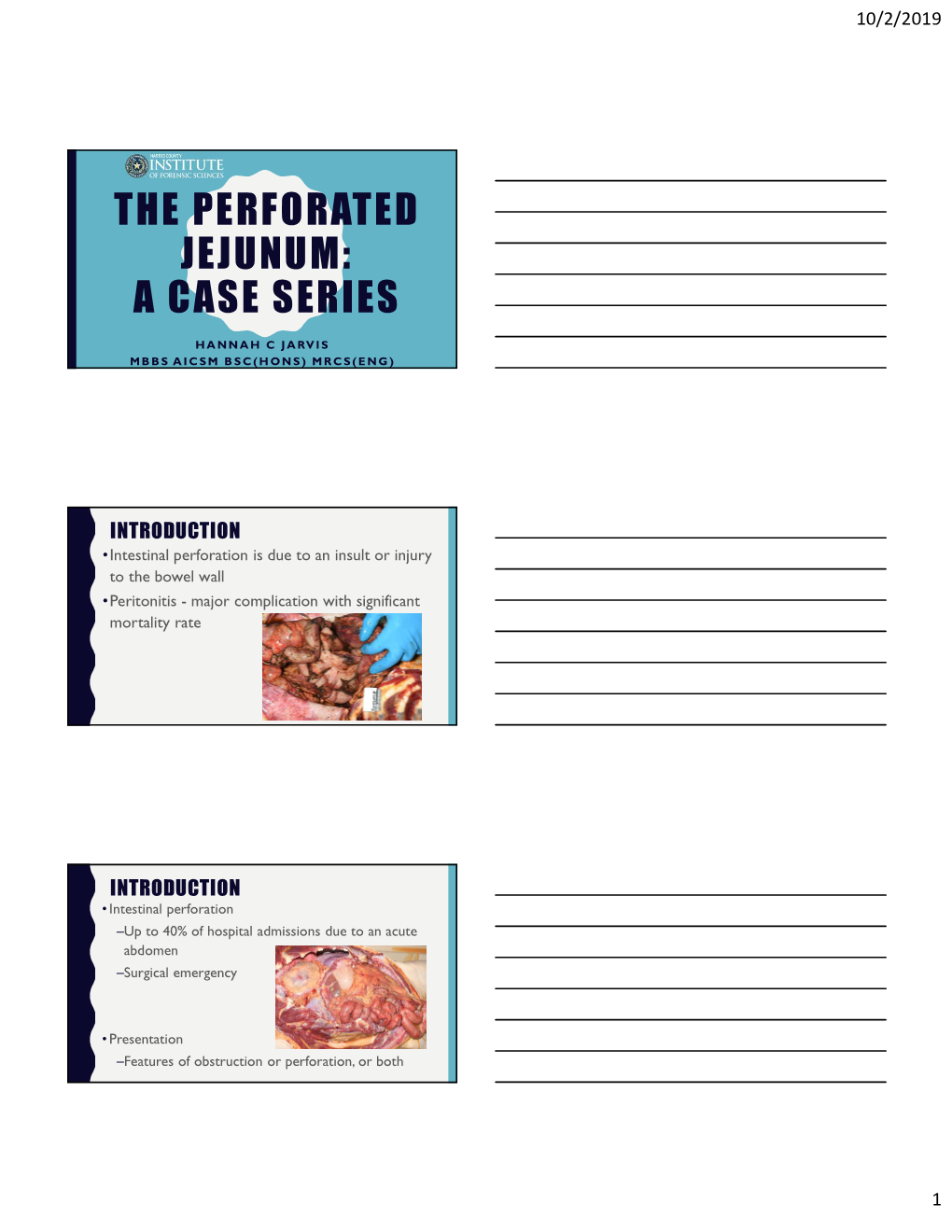 The Perforated Jejunum: a Case Series